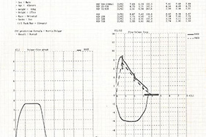 SPM300 Spirometer Test