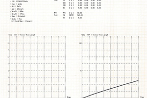 SPM300 Spirometer Test