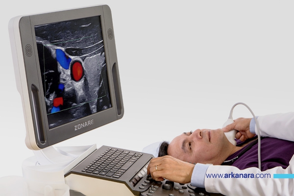 سونوگرافی ZONARE آمریکا مدل Z.ONE PRO